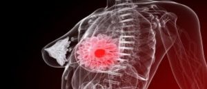 Coffee could combat breast cancer item-thumbnail